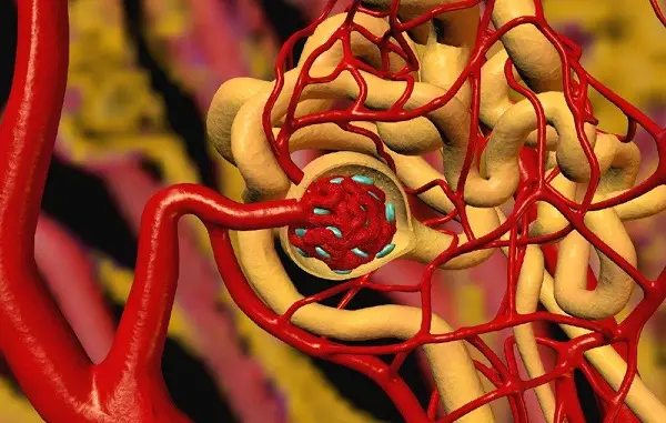 embolia gassosa circolazione sanguigna cuore